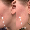 DermaDots™ | Alltid en strålande och hälsosam hud!